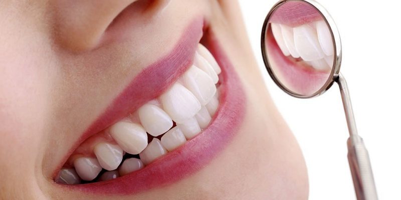 Wish to Look Younger,Understand the Smile Lift Treatment through cosmetic dental treatment