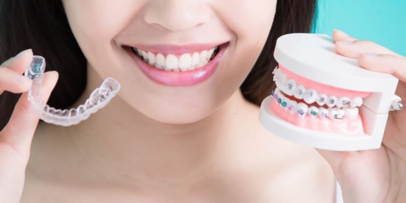 The Future Of Invisalign And Orthodontic Treatment