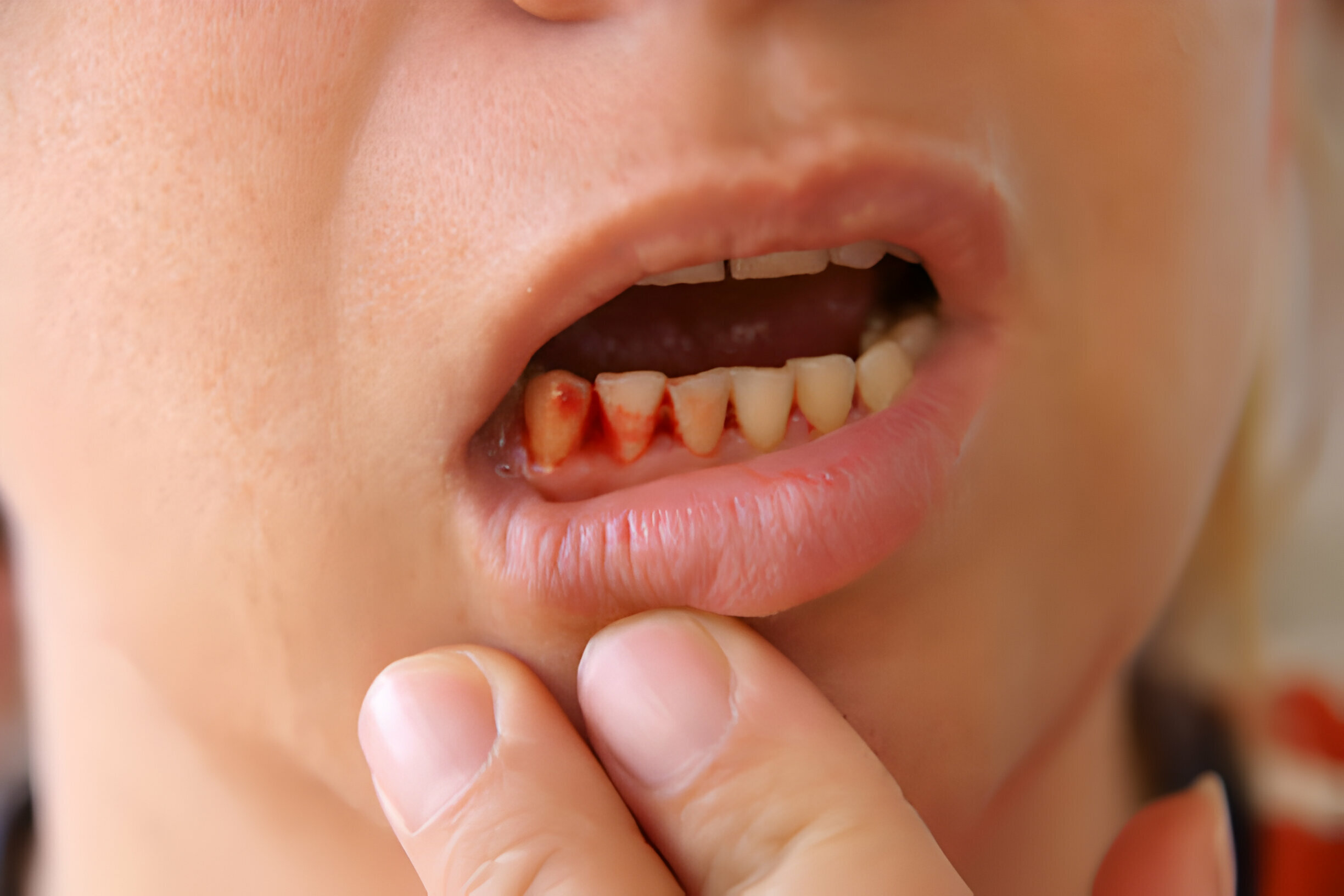 When to Seek Emergency Dental Care: Signs You Shouldn’t Ignore_3