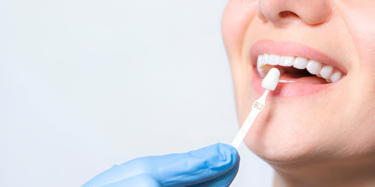 The Pros and Cons of Popular Cosmetic Dentistry Procedures_1