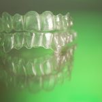 Top 10 Benefits of Choosing Invisalign for Teeth Straightening_FI