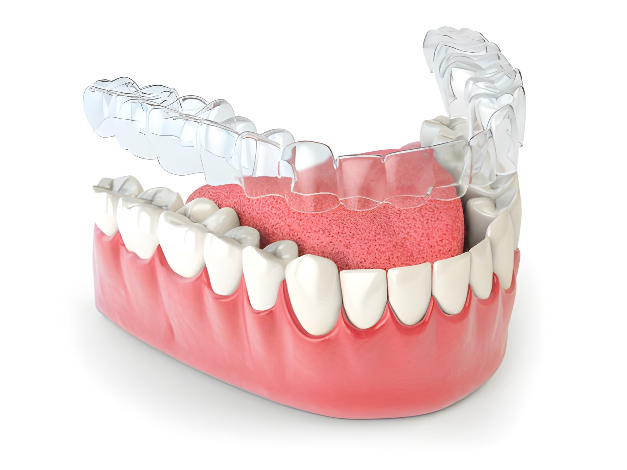 Proper Invisalign Maintenance: Expert Cleaning Tips from Your Aubrey, TX Dentist_FI